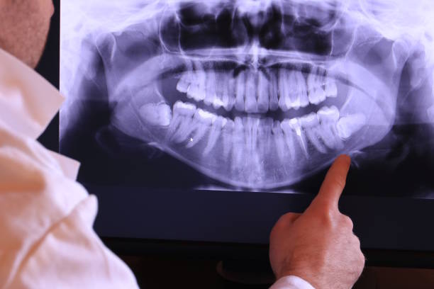 Best Chipped Tooth Repair Near Me  in Almedia, PA