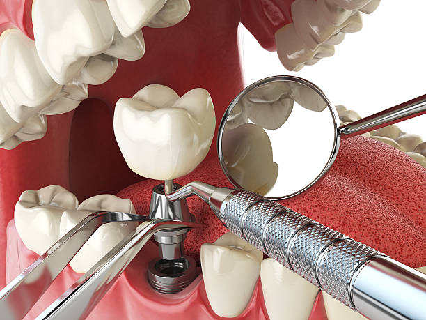 Best Emergency Gum Pain Relief  in Almedia, PA